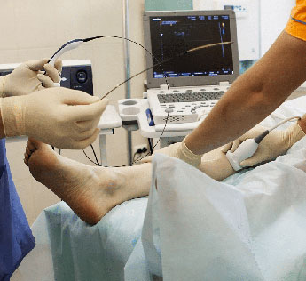 vein doctor avon ct